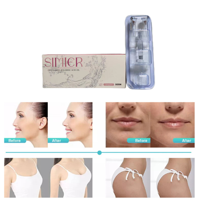 2 ml Cross Linked Dermal Filler Hoge Ha-concentratie 24mg/Ml Anti Wrinkles