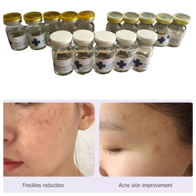 Hyamely Non Cross Linked Hyaluronic Acid Mesotherapy Solution 5 ml