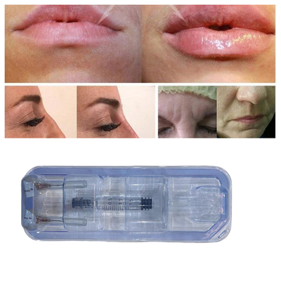 Injecteerbare Ha-hyaluronzuur Lip Filler Injecties 24 mg/ml Gezichtsverzorging