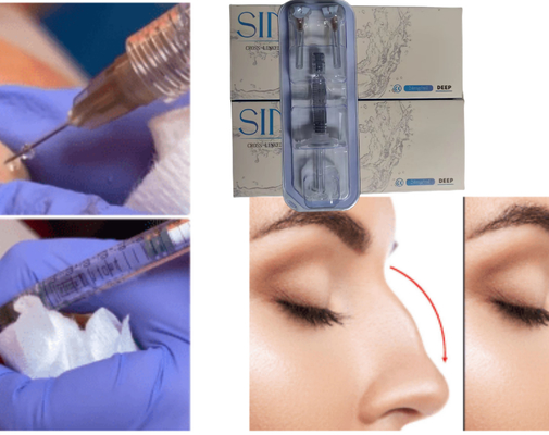Hyaluronzuur Gezicht Injectie Lip Dermale Filler Ce MSDS ISO
