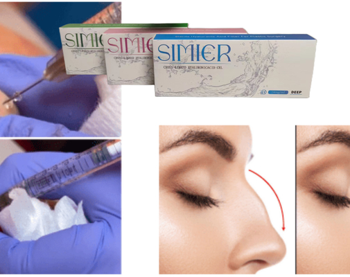 Doorzichtige 10 ml natriumhyaluronate gel injectiebehandeling voor het vullen van glimlachlijnen