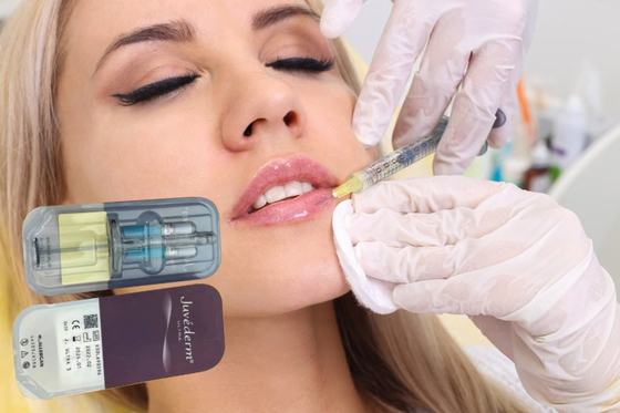 Vulstoffen Hyaluronzuurgel 5 ml Lip Dermale vulstof Injecties Injecteerbare Dermale vulstof