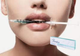 27G Marionette Lines Hyaluronzuur Filler 1ml Dieplijnfillers met Lido