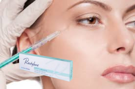 27G Marionette Lines Hyaluronzuur Filler 1ml Dieplijnfillers met Lido