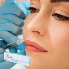 Hyaluronzuur injecteerbare huidvuller injecteerbare gel voor lippen