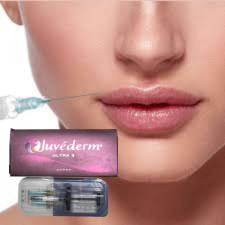 Hyaluronzuur Dermale vulmiddel Lip Injecties Juvederm Ultra3 Ultra4 Voluma