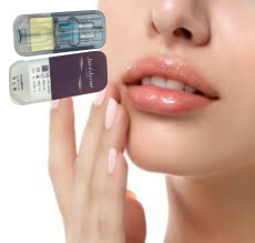Gezicht Neus Hyaluronzuur Lip Fillers Juvederm Ultra 4 24 mg/ml