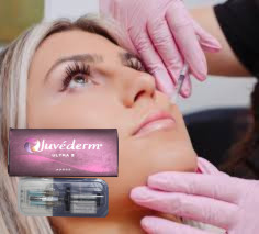 CE Hyaluronzuur Lip Fillers 24mg/Ml Juvederm Neus Filler