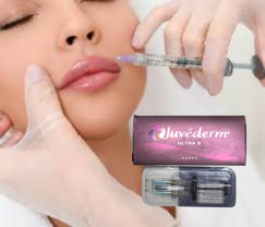 Hyaluronzuur Dermale vulmiddel Lip Injecties Juvederm Ultra3 Ultra4 Voluma