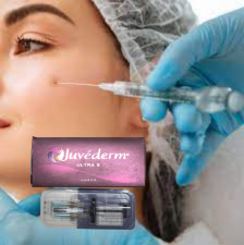 Nasolabiale plooien Lippen 2x1 ml Dermale vulmiddel Hyaluronzuur Juvederm Ultra3
