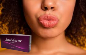Juvederm Ultra 3 Ultra 4 Hyaluronzuurvuller voor lippenvergroting