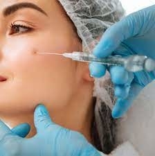 Glanzere rimpels Injecteerbare huidvuller Hyaluronzuur Juvederm Ultra 3 2*1ml