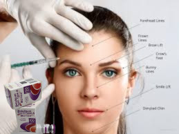 Huidverzorging Injecties Allergan Botox 100 Eenheden Type A Wit poeder